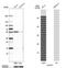 Lysophosphatidylcholine Acyltransferase 1 antibody, NBP1-88923, Novus Biologicals, Western Blot image 