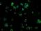 Thiopurine S-Methyltransferase antibody, NBP2-02356, Novus Biologicals, Immunocytochemistry image 