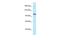 Minichromosome Maintenance Complex Component 4 antibody, PA5-68750, Invitrogen Antibodies, Western Blot image 