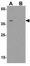 Zinc Finger Protein 821 antibody, GTX32123, GeneTex, Western Blot image 