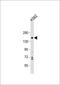 PH Domain And Leucine Rich Repeat Protein Phosphatase 1 antibody, GTX81275, GeneTex, Western Blot image 