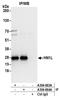 Jupiter Microtubule Associated Homolog 2 antibody, A304-663A, Bethyl Labs, Immunoprecipitation image 