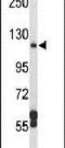 Dipeptidyl Peptidase 8 antibody, PA5-25893, Invitrogen Antibodies, Western Blot image 