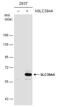 Solute Carrier Family 39 Member 4 antibody, GTX130262, GeneTex, Western Blot image 