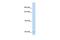 Solute Carrier Family 19 Member 1 antibody, GTX46753, GeneTex, Western Blot image 