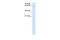 Phospholipase A And Acyltransferase 4 antibody, 30-204, ProSci, Western Blot image 