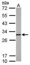 Adenylate kinase 2, mitochondrial antibody, GTX107613, GeneTex, Western Blot image 