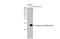 Dengue virus antibody, GTX132069, GeneTex, Western Blot image 