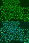 TAR DNA Binding Protein antibody, LS-C748456, Lifespan Biosciences, Immunofluorescence image 