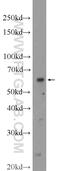 Transmembrane Protein 87A antibody, 25091-1-AP, Proteintech Group, Western Blot image 