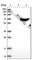 Carnitine O-Octanoyltransferase antibody, HPA019052, Atlas Antibodies, Western Blot image 