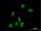 Rho GTPase Activating Protein 9 antibody, H00064333-B01P, Novus Biologicals, Immunocytochemistry image 