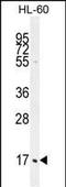 Complement C1q C Chain antibody, PA5-35084, Invitrogen Antibodies, Western Blot image 