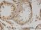 Interleukin 13 antibody, H00003596-M07, Novus Biologicals, Immunohistochemistry paraffin image 