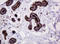 Mucin 1, Cell Surface Associated antibody, LS-C175473, Lifespan Biosciences, Immunohistochemistry frozen image 