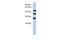 Protein Phosphatase 1 Regulatory Subunit 13B antibody, GTX46274, GeneTex, Western Blot image 