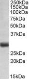 Methylenetetrahydrofolate Reductase antibody, 42-899, ProSci, Western Blot image 