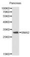 Snail Family Transcriptional Repressor 2 antibody, abx000980, Abbexa, Western Blot image 