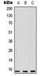 Proliferation And Apoptosis Adaptor Protein 15 antibody, LS-C368455, Lifespan Biosciences, Western Blot image 