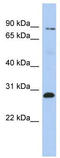 Zinc Finger Protein 148 antibody, TA337247, Origene, Western Blot image 