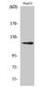 FACT complex subunit SPT16 antibody, A05199, Boster Biological Technology, Western Blot image 