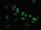 Lin-28 Homolog A antibody, LS-C673173, Lifespan Biosciences, Immunofluorescence image 