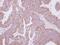 Autophagy Related 4B Cysteine Peptidase antibody, GTX115678, GeneTex, Immunohistochemistry paraffin image 
