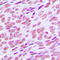 Cyclin E1 antibody, LS-C353930, Lifespan Biosciences, Immunohistochemistry frozen image 