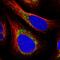 VPS26, Retromer Complex Component B antibody, PA5-58282, Invitrogen Antibodies, Immunofluorescence image 
