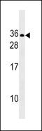 Relaxin 2 antibody, 60-368, ProSci, Western Blot image 