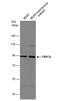 Transient Receptor Potential Cation Channel Subfamily C Member 6 antibody, NBP2-20738, Novus Biologicals, Western Blot image 