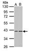 Protein Kinase CAMP-Activated Catalytic Subunit Alpha antibody, LS-C185887, Lifespan Biosciences, Western Blot image 