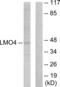 LIM Domain Only 4 antibody, abx013553, Abbexa, Western Blot image 