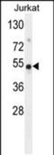 Family With Sequence Similarity 118 Member B antibody, PA5-48248, Invitrogen Antibodies, Western Blot image 