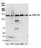 Cleavage And Polyadenylation Specific Factor 1 antibody, A301-580A, Bethyl Labs, Western Blot image 