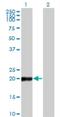 COP9 Signalosome Subunit 8 antibody, H00010920-M04, Novus Biologicals, Western Blot image 