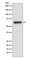 Immunoglobulin Heavy Constant Gamma 3 (G3m Marker) antibody, M08374, Boster Biological Technology, Western Blot image 