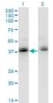 Zinc Finger Protein 444 antibody, H00055311-M02, Novus Biologicals, Western Blot image 