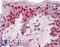 Lysyl Oxidase antibody, LS-B9417, Lifespan Biosciences, Immunohistochemistry paraffin image 