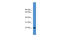 Nudix Hydrolase 16 Like 1 antibody, ARP48417_P050, Aviva Systems Biology, Western Blot image 