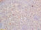 Repulsive Guidance Molecule BMP Co-Receptor A antibody, GTX51106, GeneTex, Immunohistochemistry paraffin image 