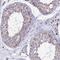 Estradiol 17-beta-dehydrogenase 8 antibody, HPA042132, Atlas Antibodies, Immunohistochemistry frozen image 