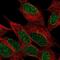 Inositol Polyphosphate-4-Phosphatase Type I A antibody, NBP1-92023, Novus Biologicals, Immunofluorescence image 