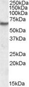 Inosine Monophosphate Dehydrogenase 2 antibody, EB08992, Everest Biotech, Western Blot image 