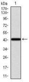 Keratin 13 antibody, NBP2-37468, Novus Biologicals, Western Blot image 
