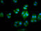 Hemoglobin Subunit Gamma 2 antibody, CSB-PA010156LA01HU, Cusabio, Immunofluorescence image 