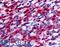 Fms Related Tyrosine Kinase 3 antibody, LS-A7148, Lifespan Biosciences, Immunohistochemistry paraffin image 