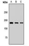 Alsin Rho Guanine Nucleotide Exchange Factor ALS2 antibody, LS-C668556, Lifespan Biosciences, Western Blot image 