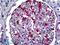 Protein S100-A6 antibody, LS-B5528, Lifespan Biosciences, Immunohistochemistry frozen image 