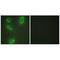 Branched Chain Keto Acid Dehydrogenase Kinase antibody, A07798, Boster Biological Technology, Immunohistochemistry paraffin image 